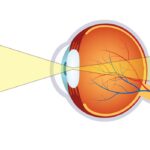 Image Formation and Detection