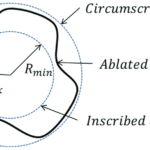 ROUNDNESS MEASUREMENT